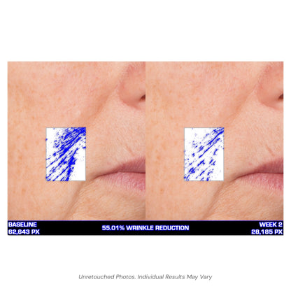 Serious Skincare Ultra Mare Serum hydrating anti-aging facial serum to smooth, nourish and improve the look of fine lines, wrinkles and aging skin.
